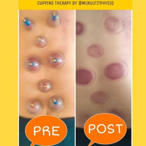 ✨Cupping session to Hari prasad sharma CEO of Shree RSH group kolkata at hotel marriot jaipur